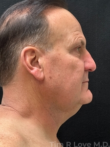 Compare-before