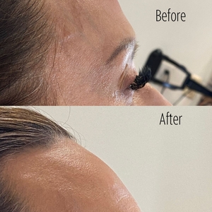 Filler SBA B/A 38-before