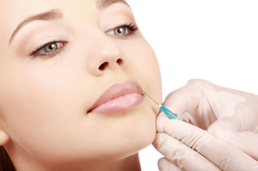 Lip Filler