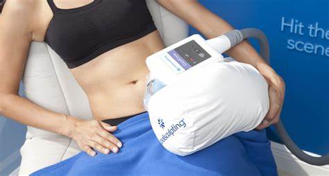 Coolsculpting