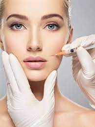 Nasolabial Filler
