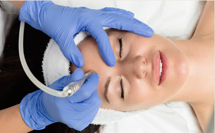 Microdermabrasion