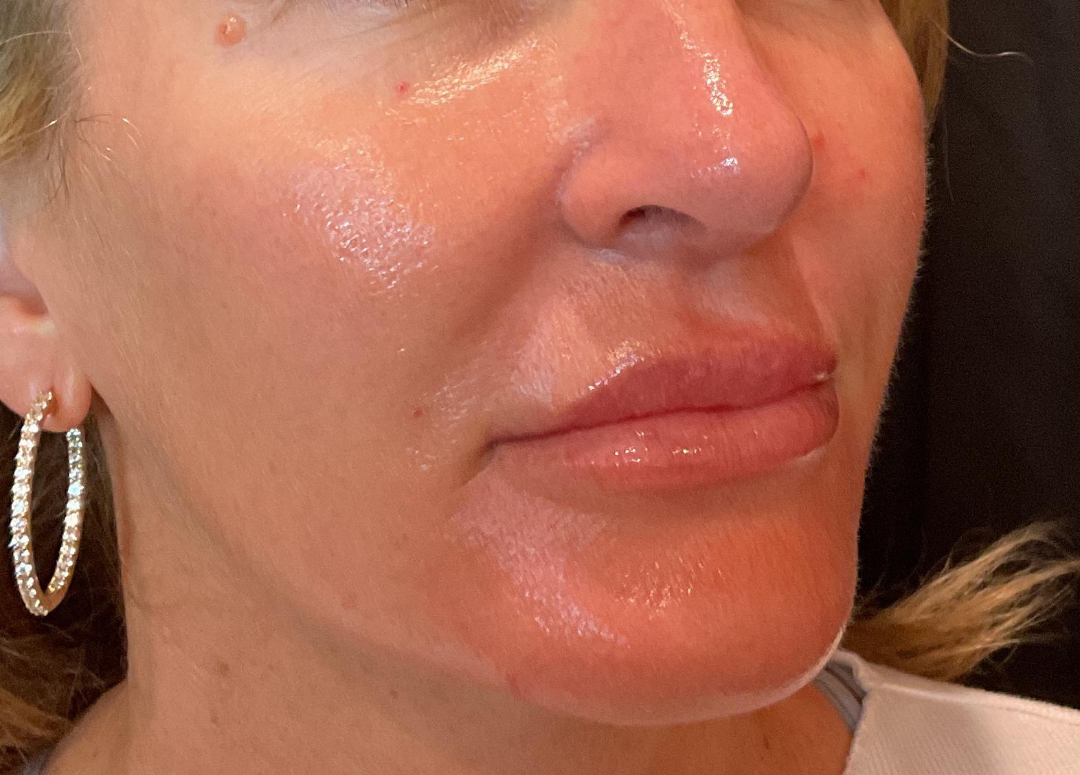 1 month Later-before