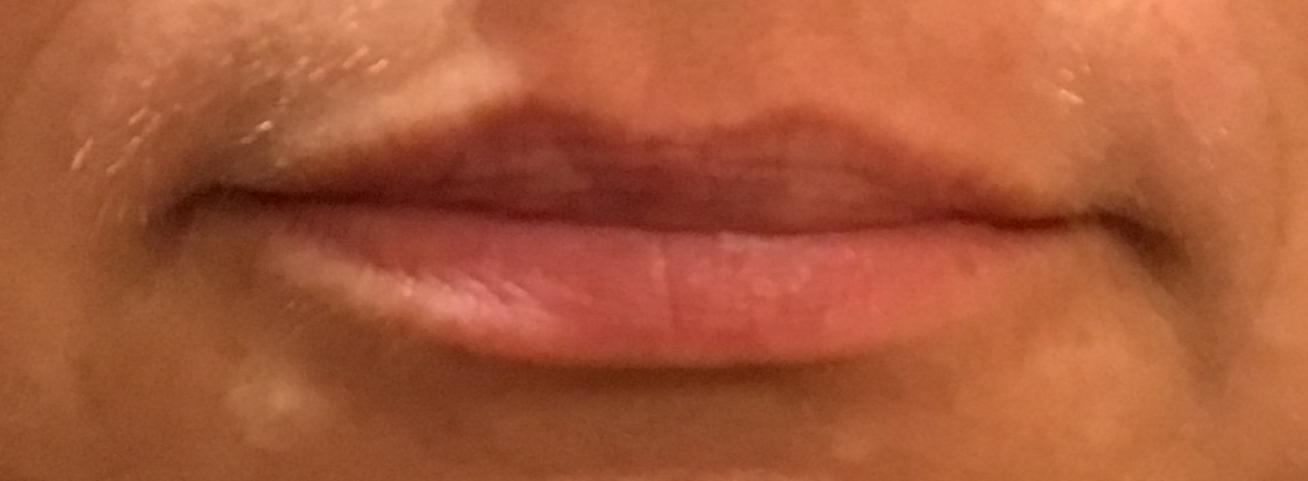 Lips-before