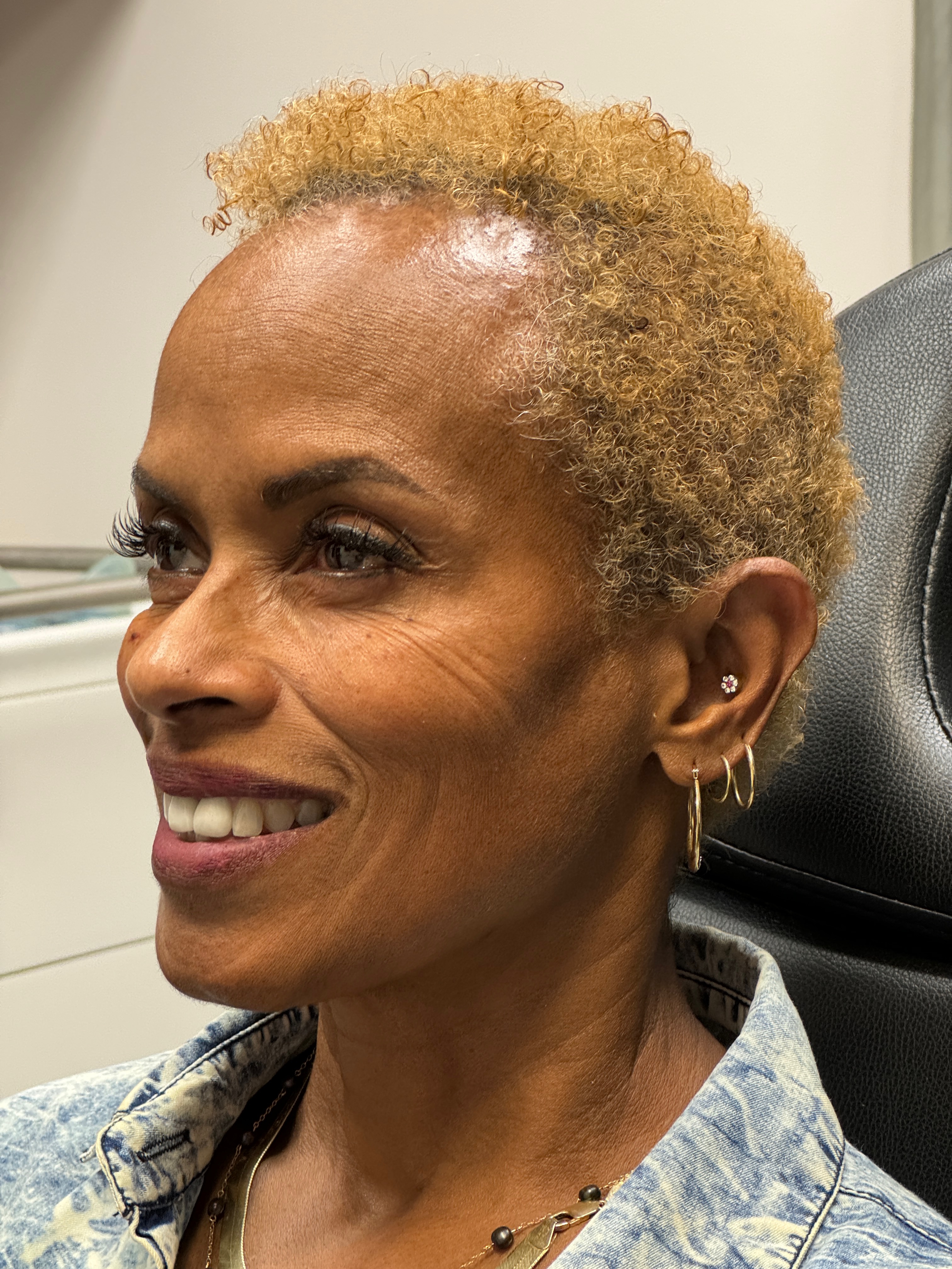 Ashley Reich RN. Treated with Jeuveau-after