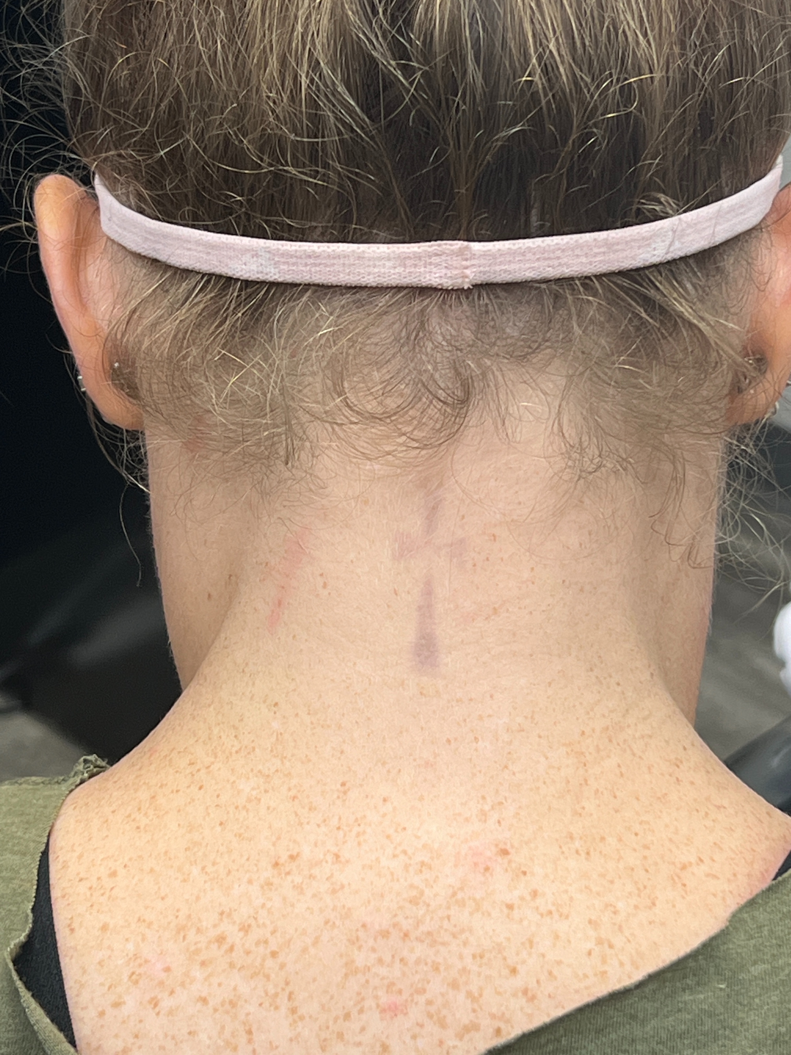 Ashley Reich RN.- In Progress - Not Final-after