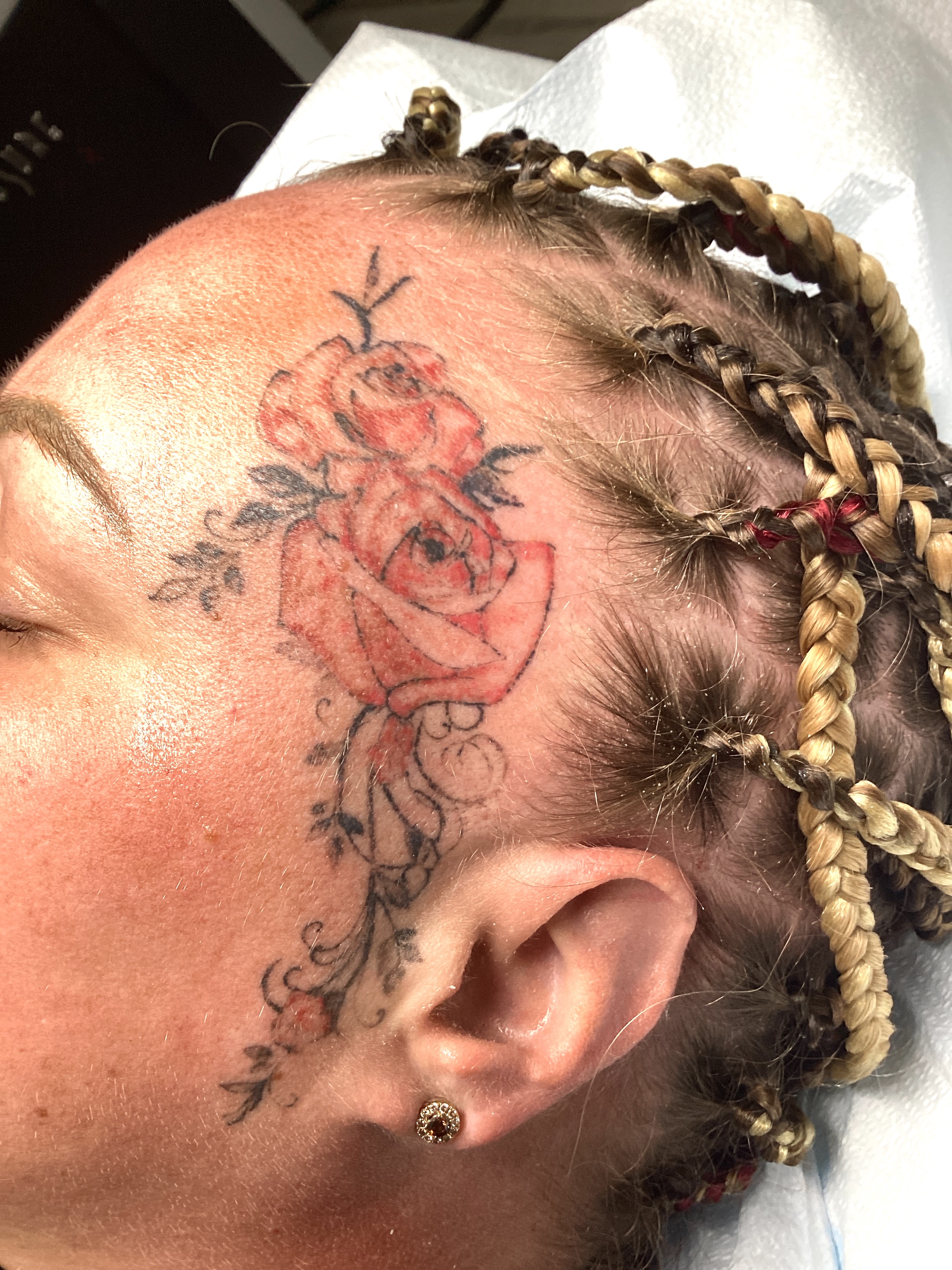 10 sessions-before