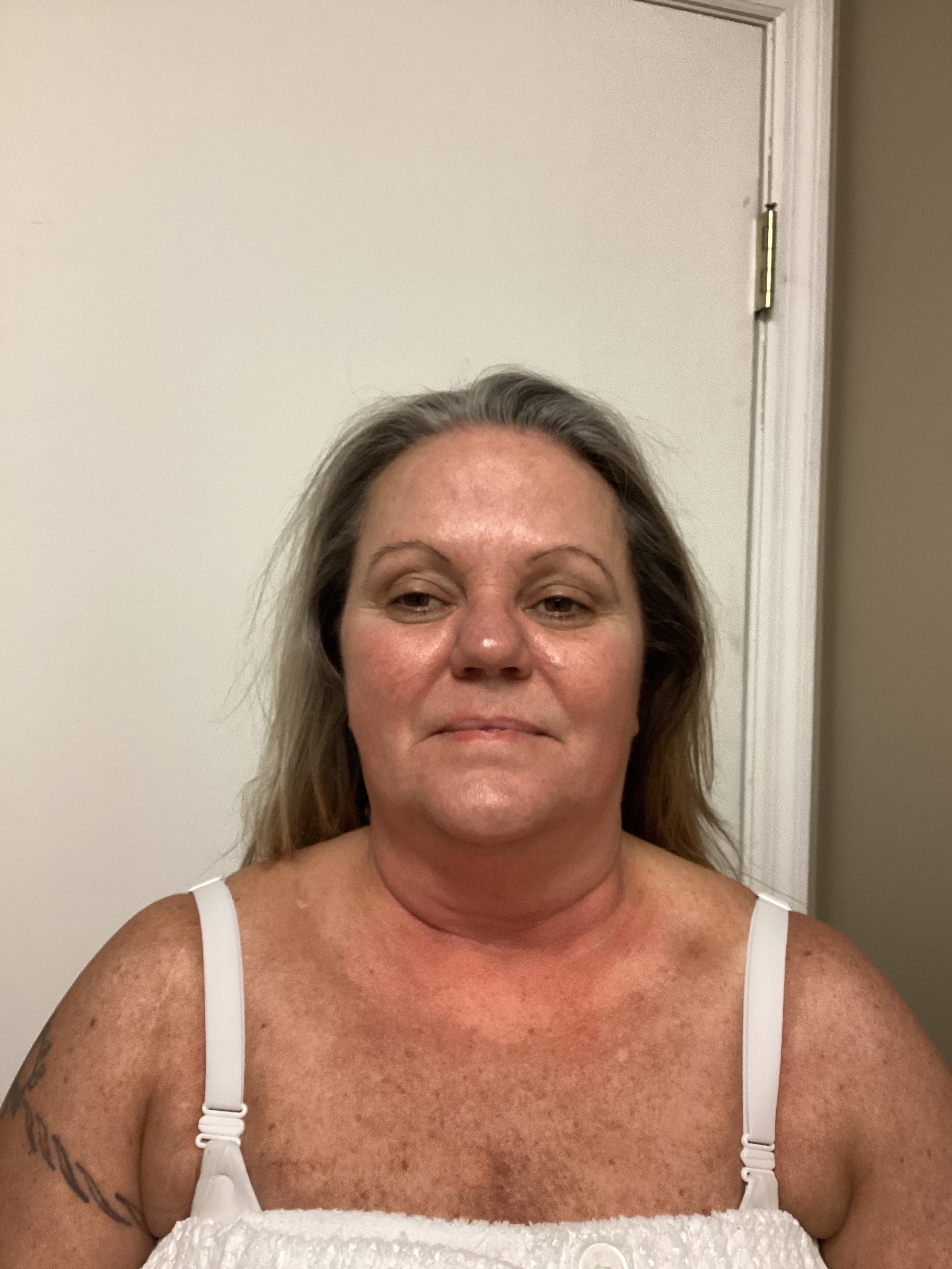 1 Treatment! -AJ-after