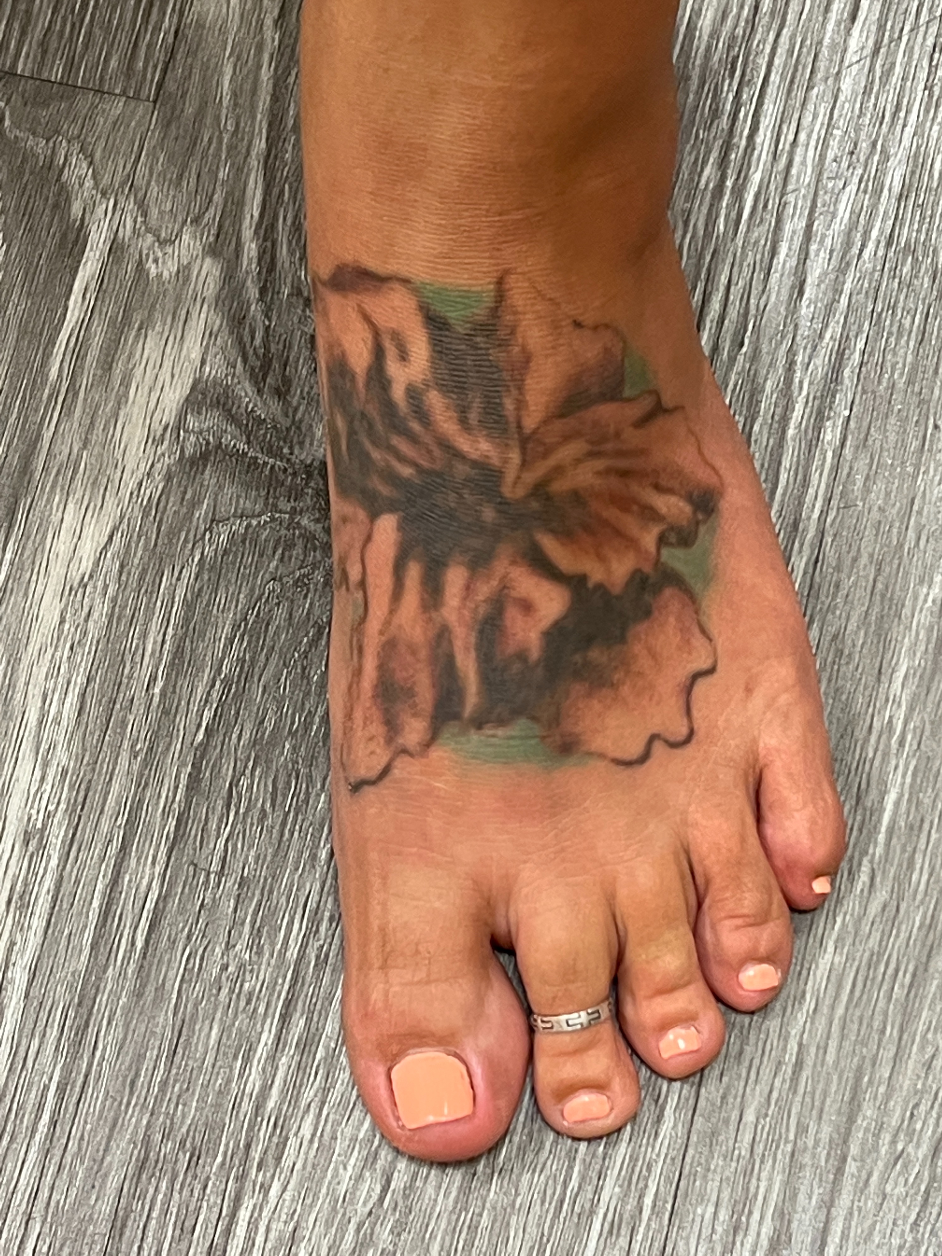 Ashley Reich RN. - 11 Treatments (Cover-up)-before