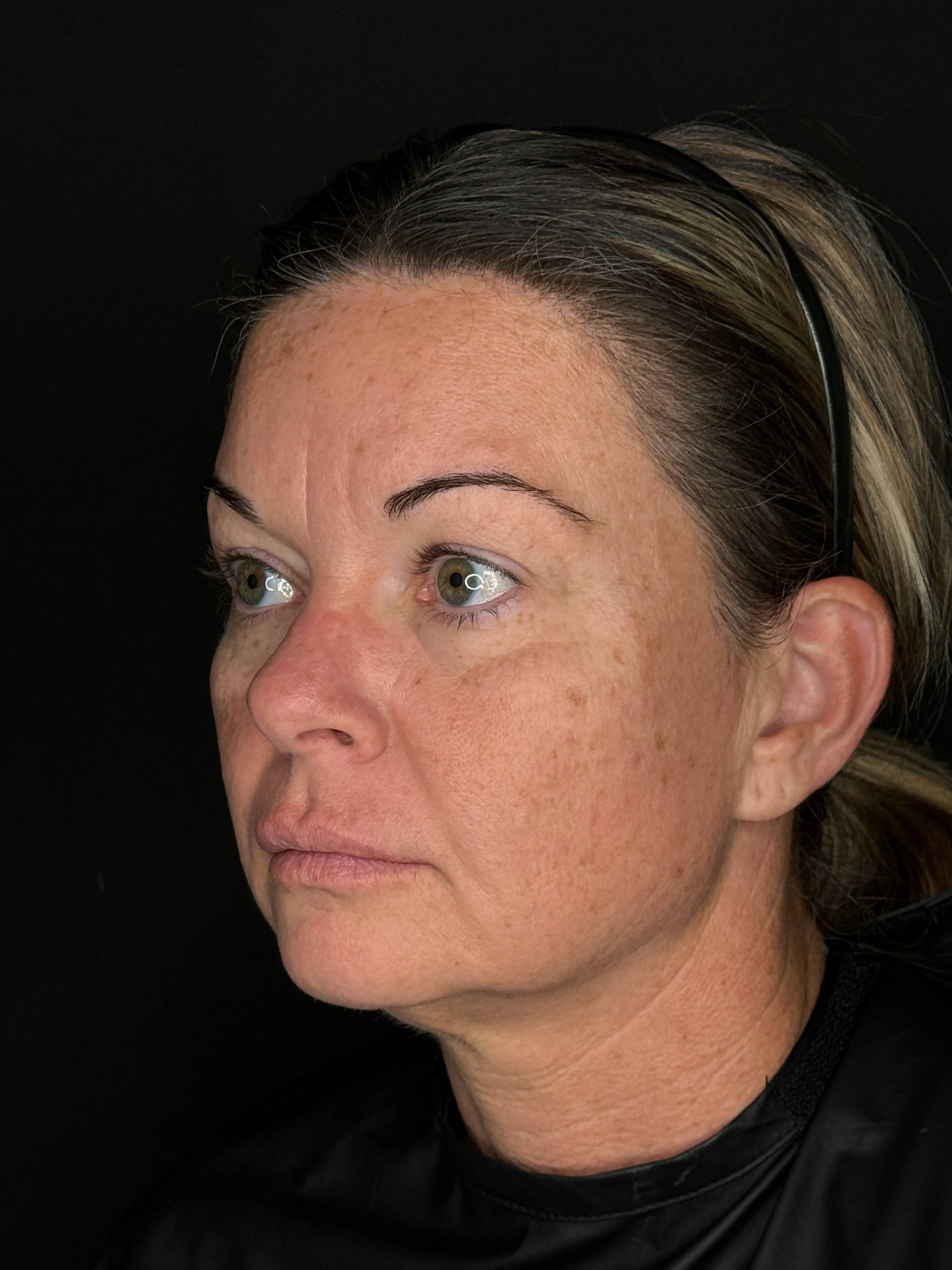 Trisha O'Meara NP. - Threads-before