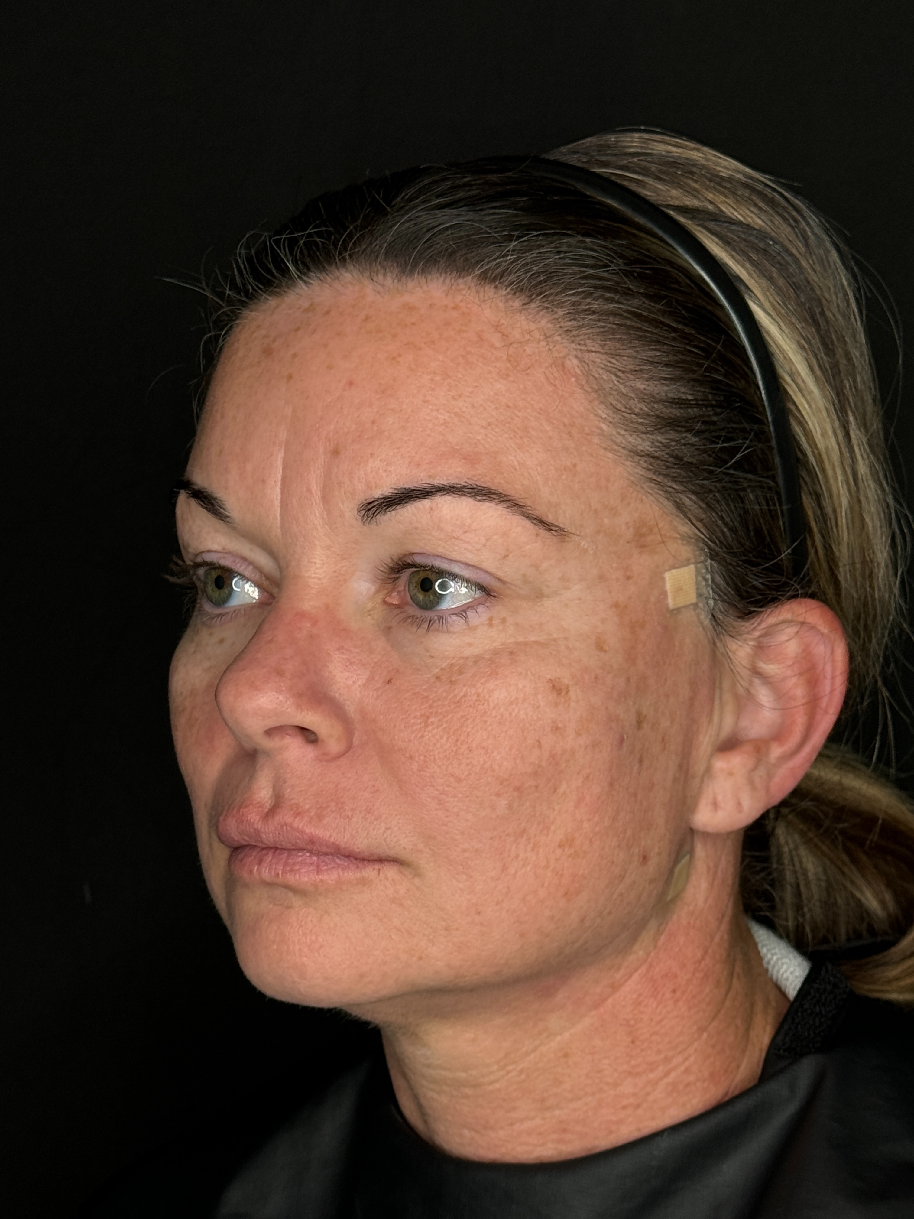 Trisha O'Meara NP. - Threads-after