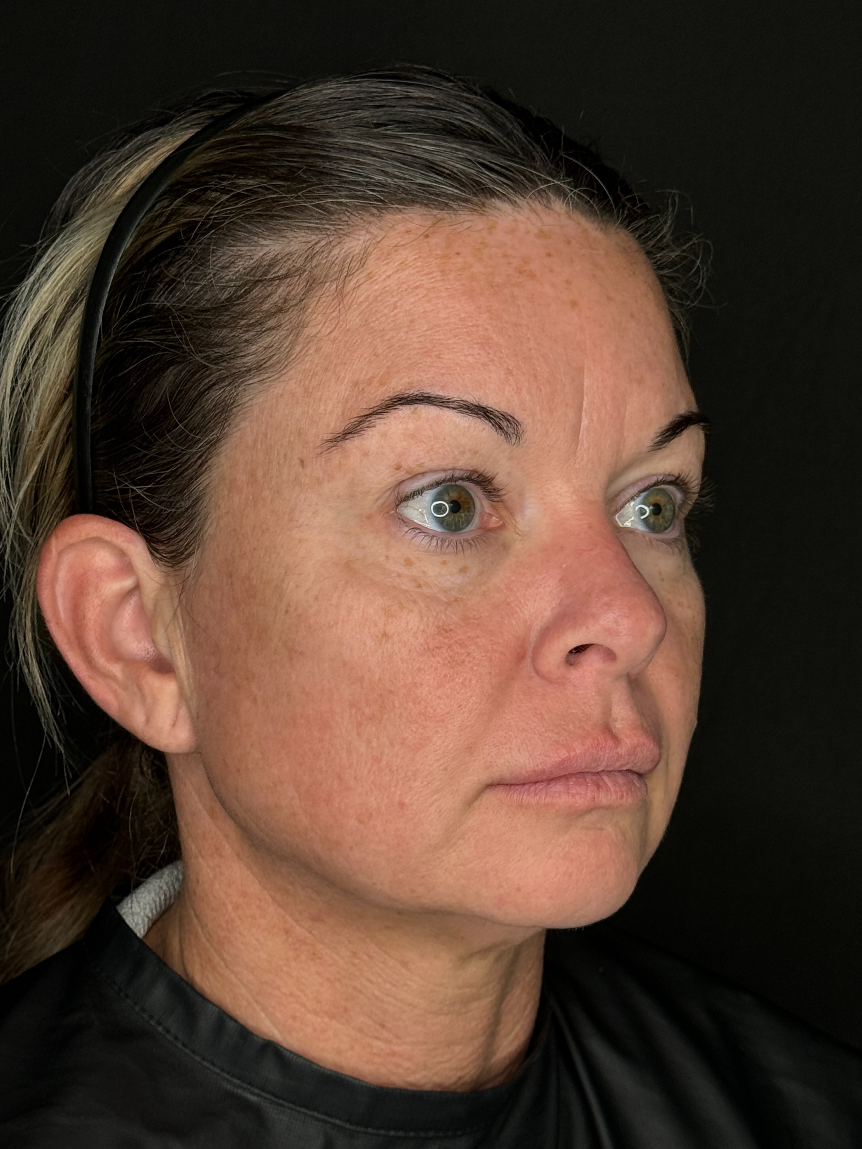 Trisha O'Meara NP. - Threads-before