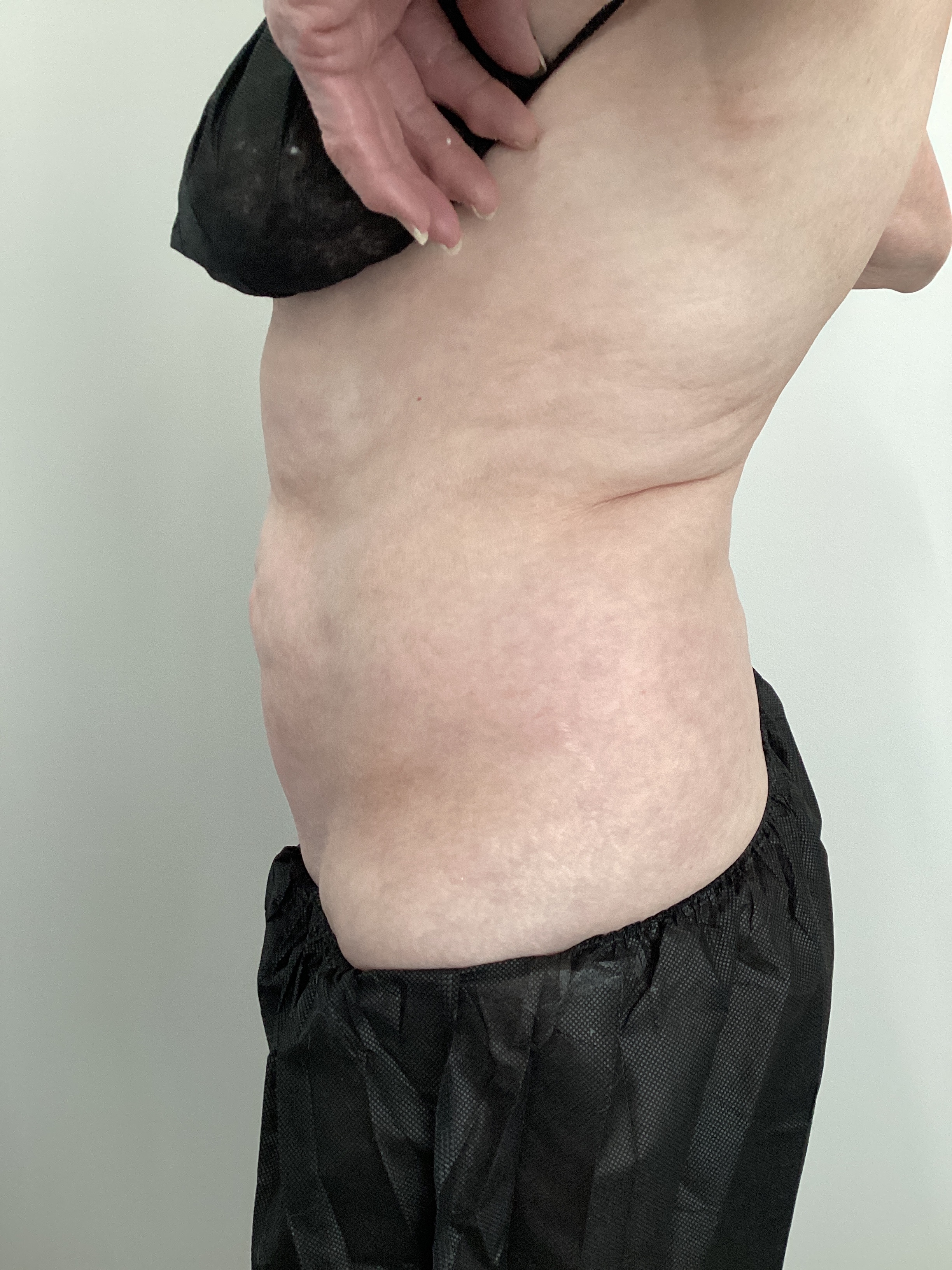 1 double ab session-after