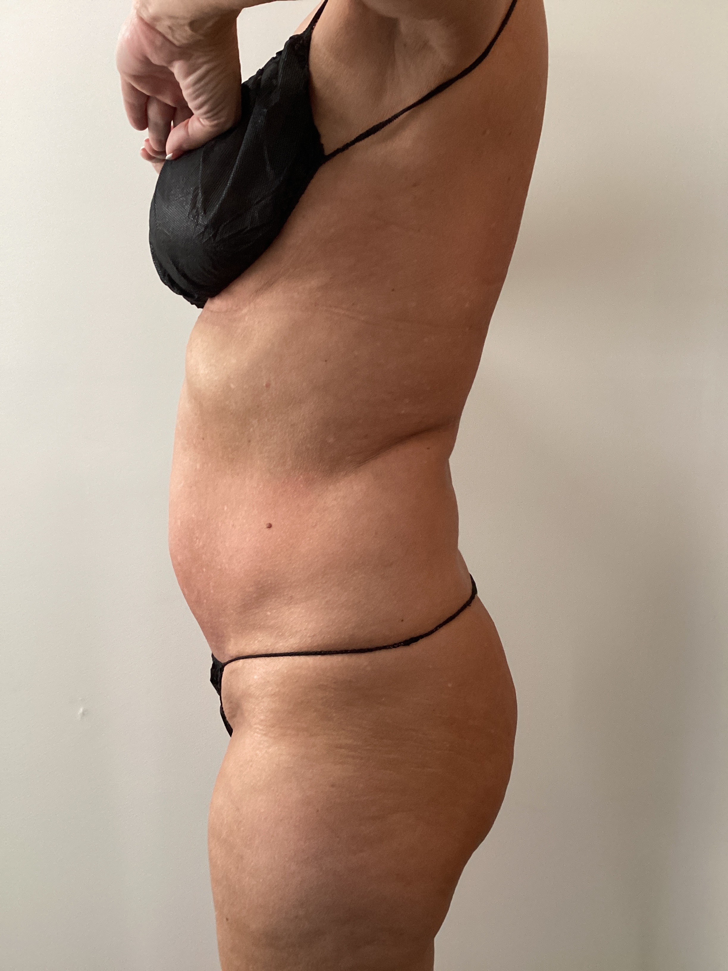 After 1 insta ab session-after