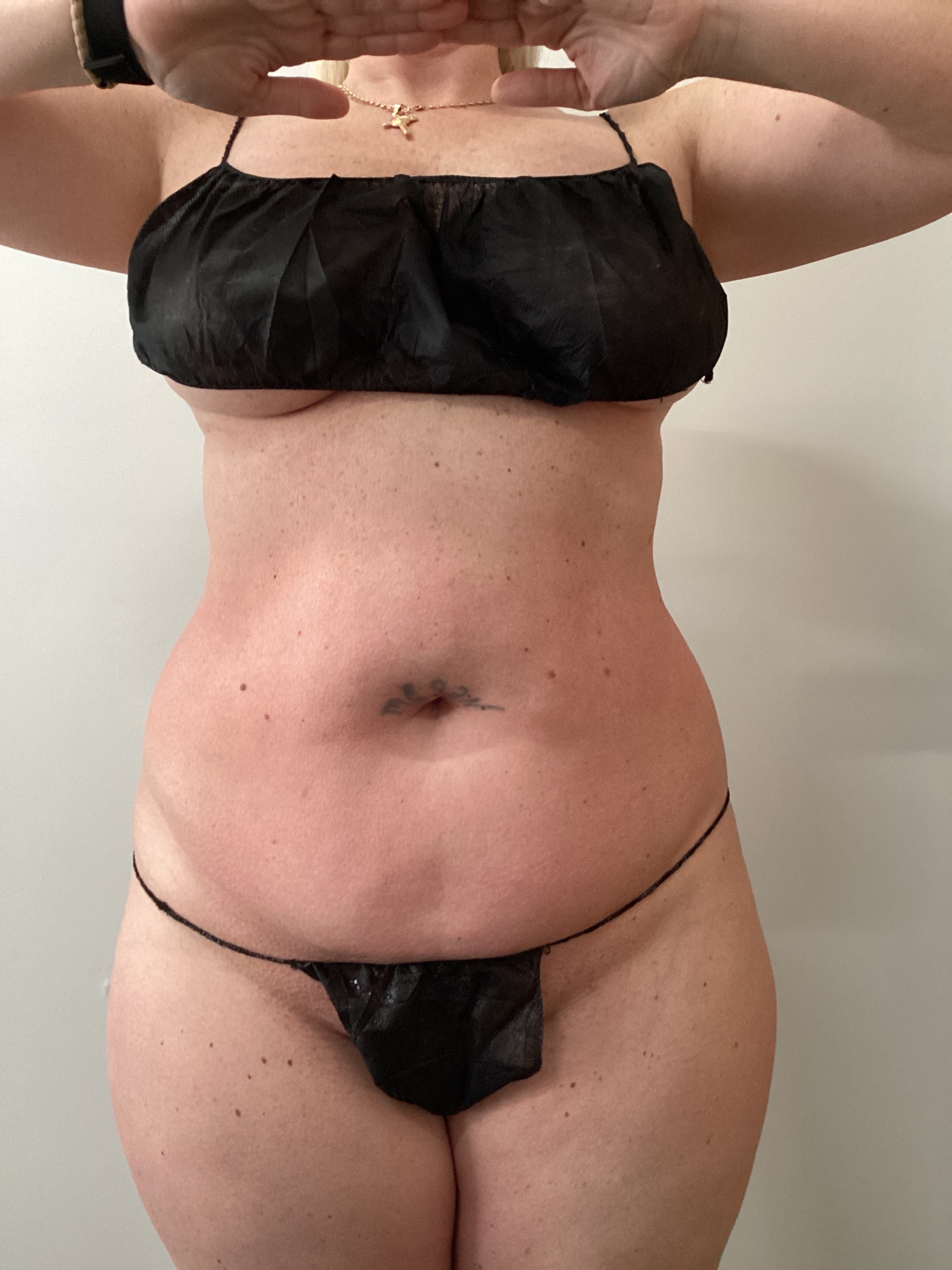 1 Session double ab-after