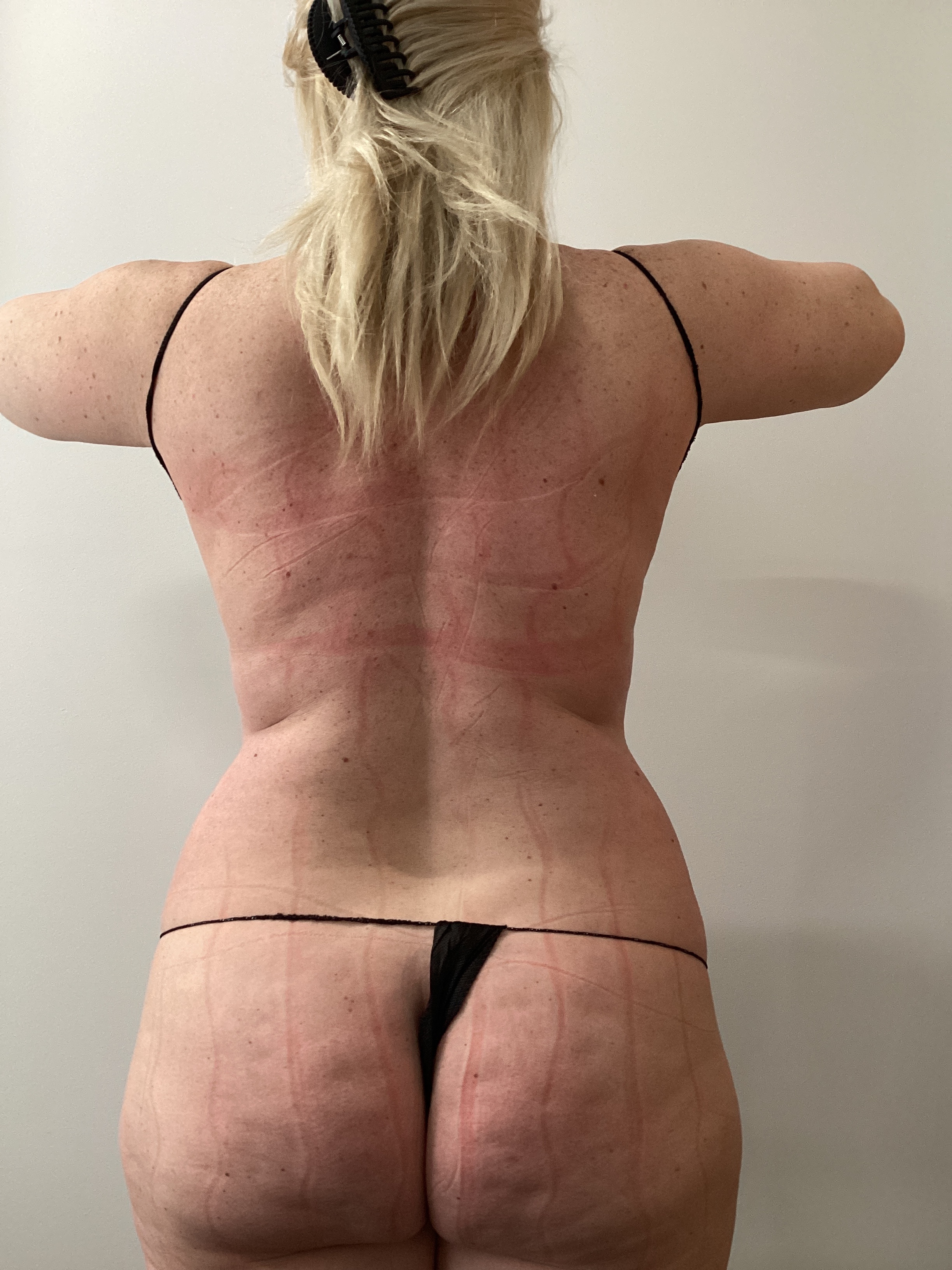 1 Session double ab-after