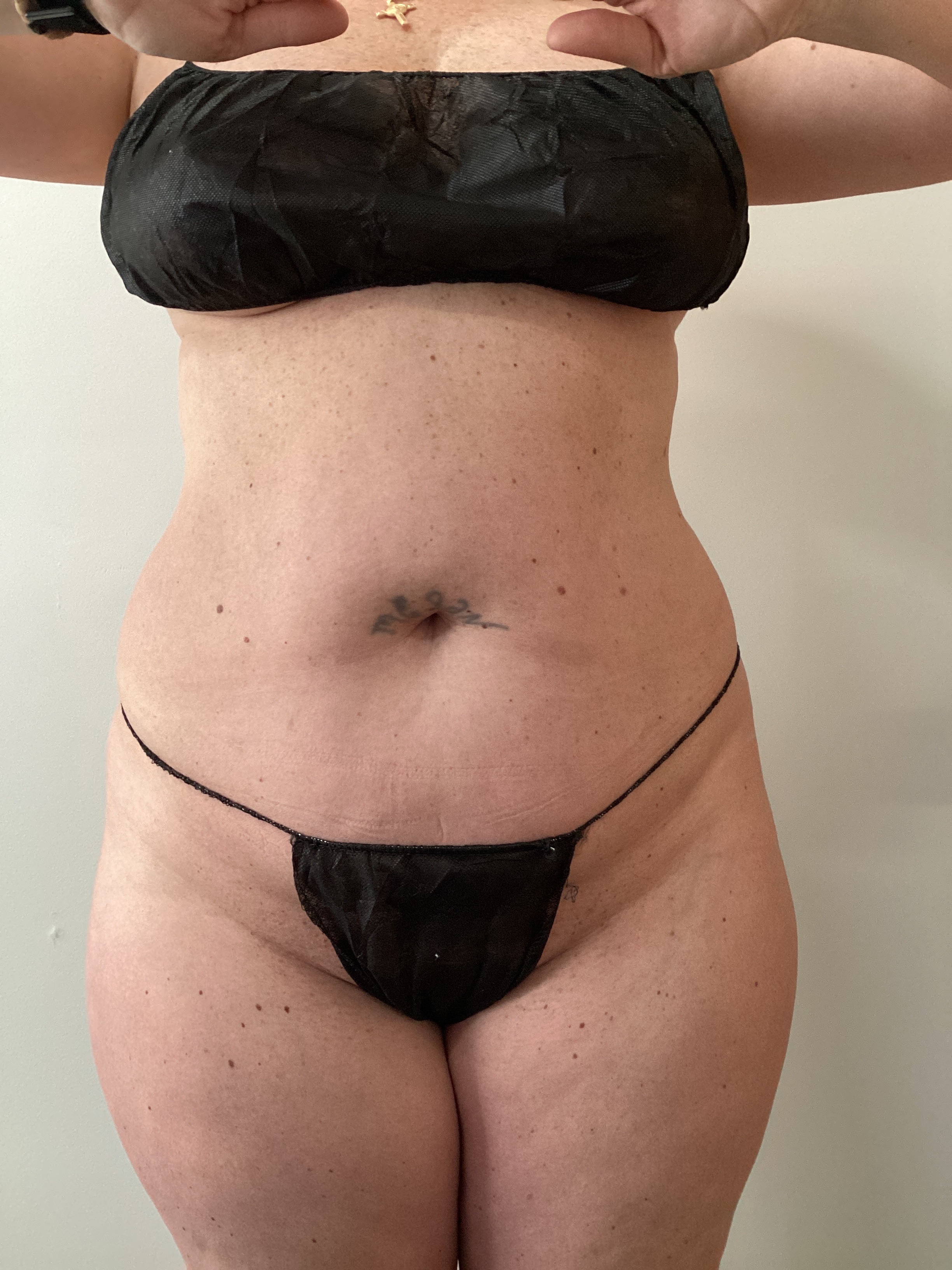 1 Session double ab-before