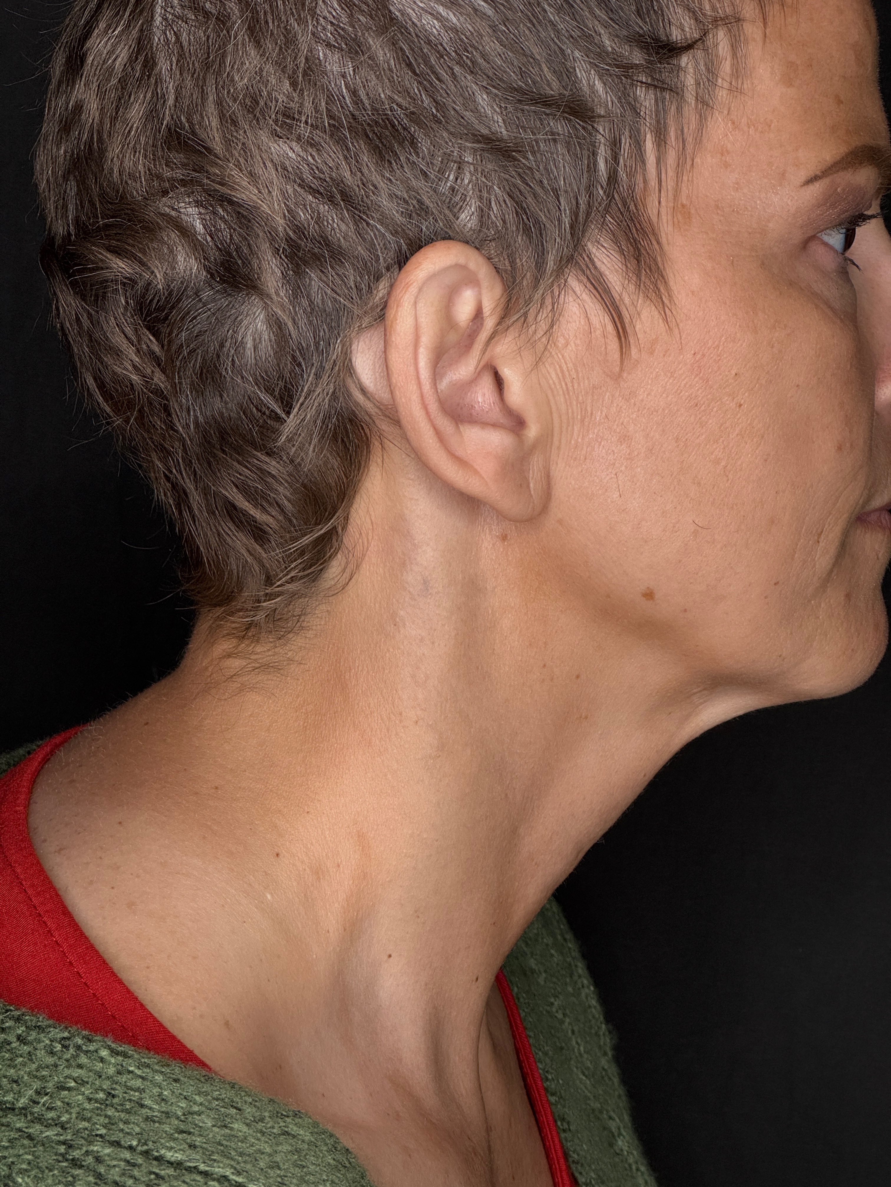 8 Sessions on the Pico Discovery - Ashley Reich RN.-after