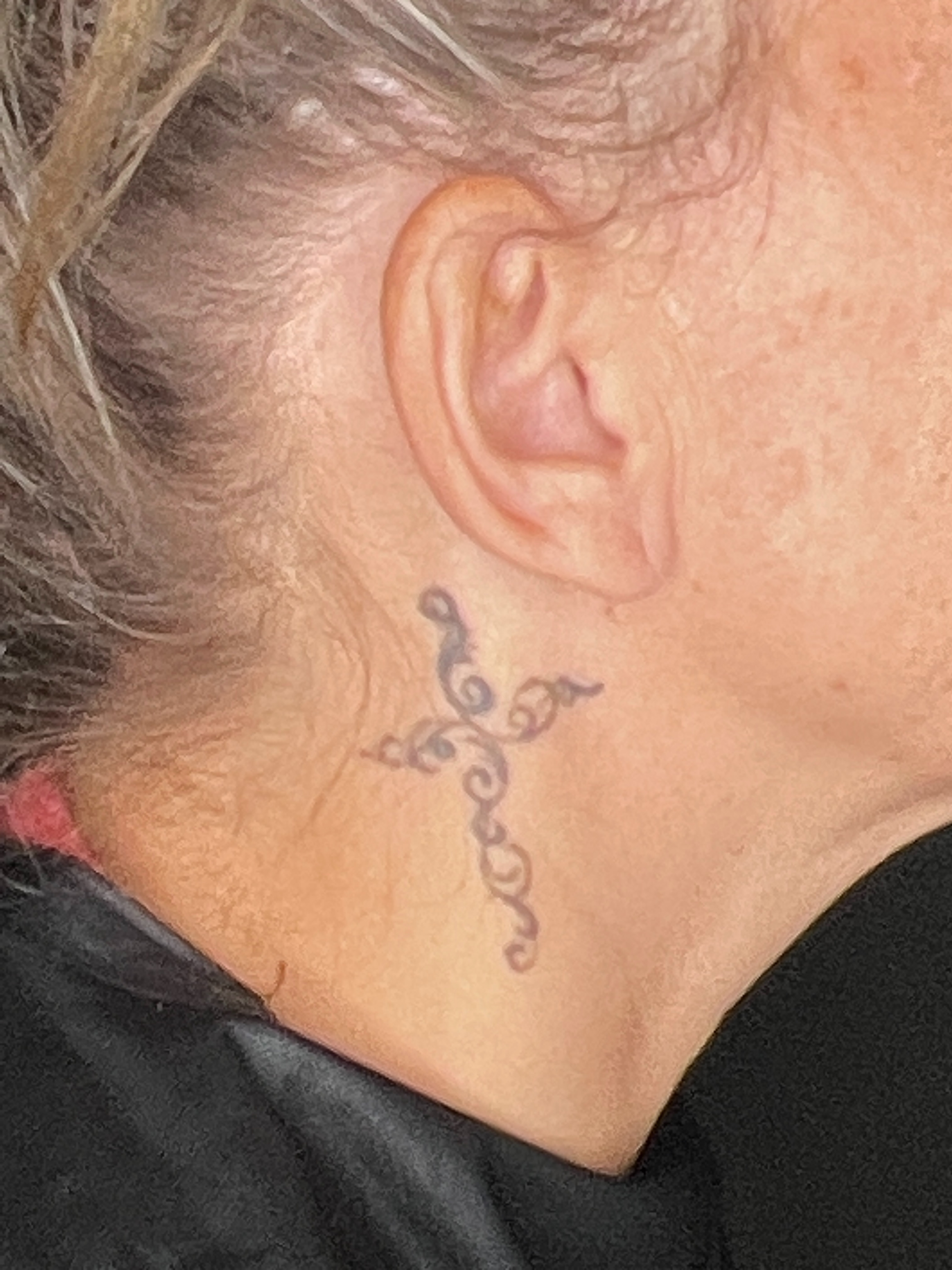 8 Sessions on the Pico Discovery - Ashley Reich RN.-before