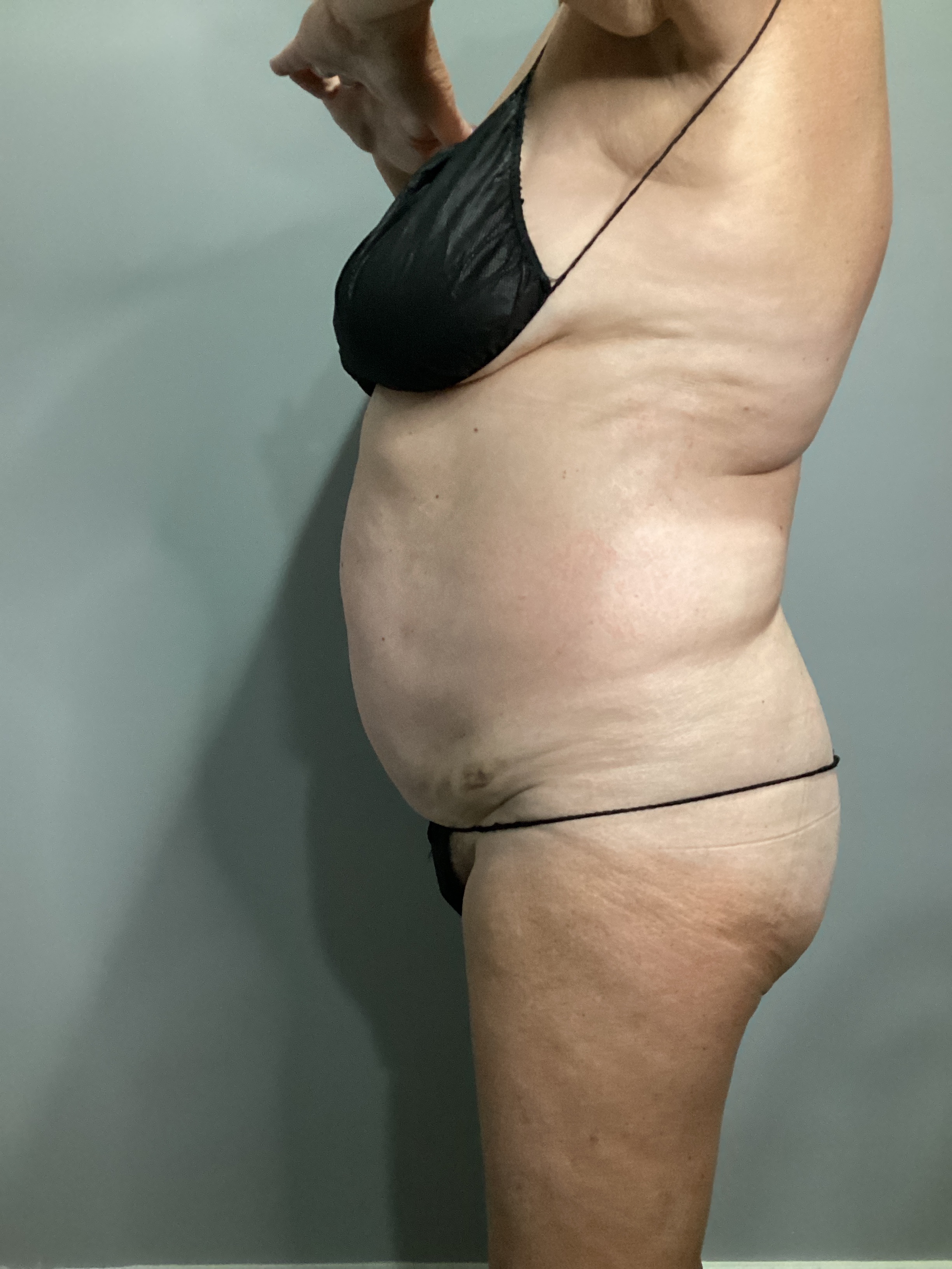 7 Sessions Insta ABD-after