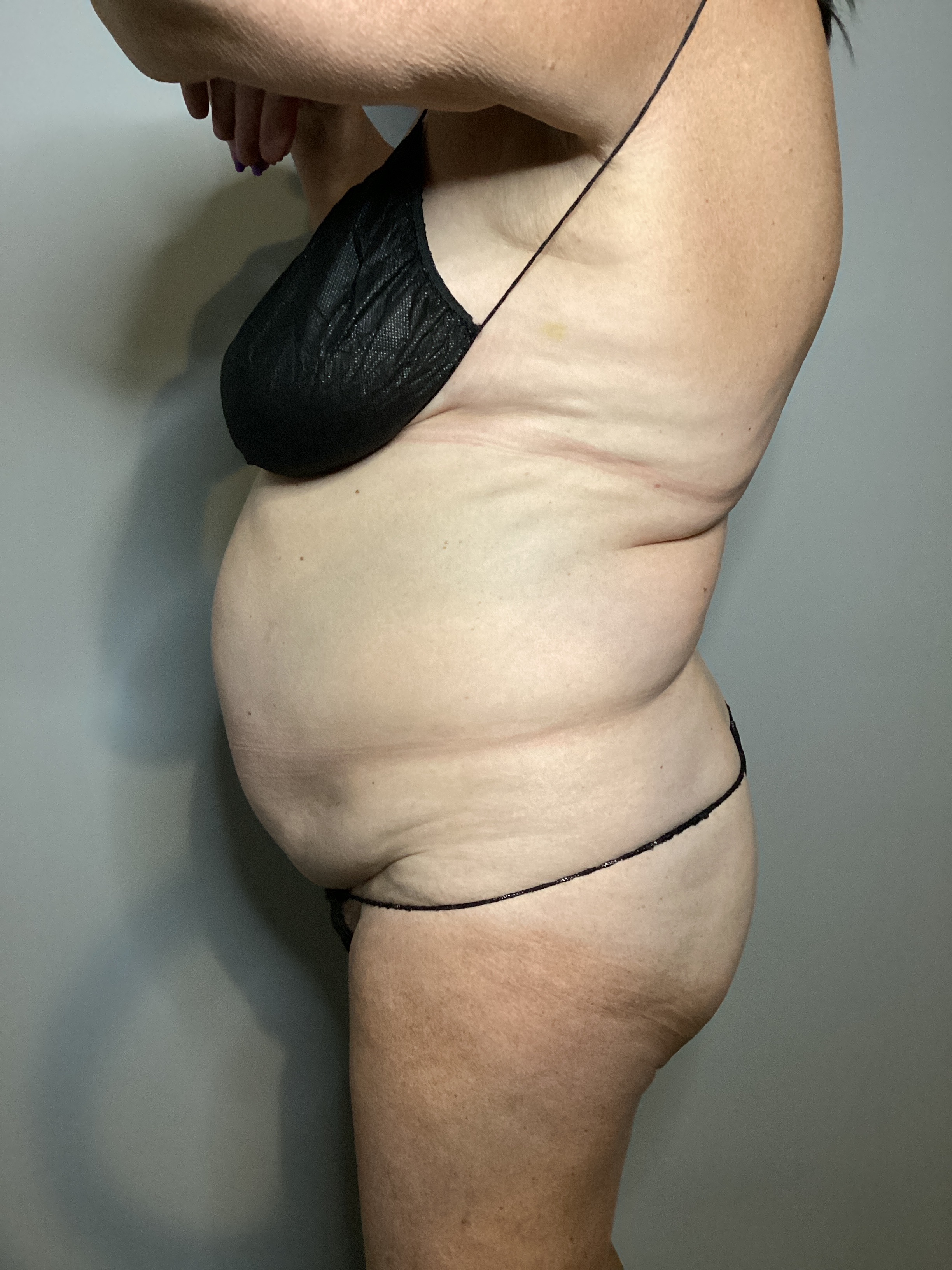 7 Sessions Insta ABD-before