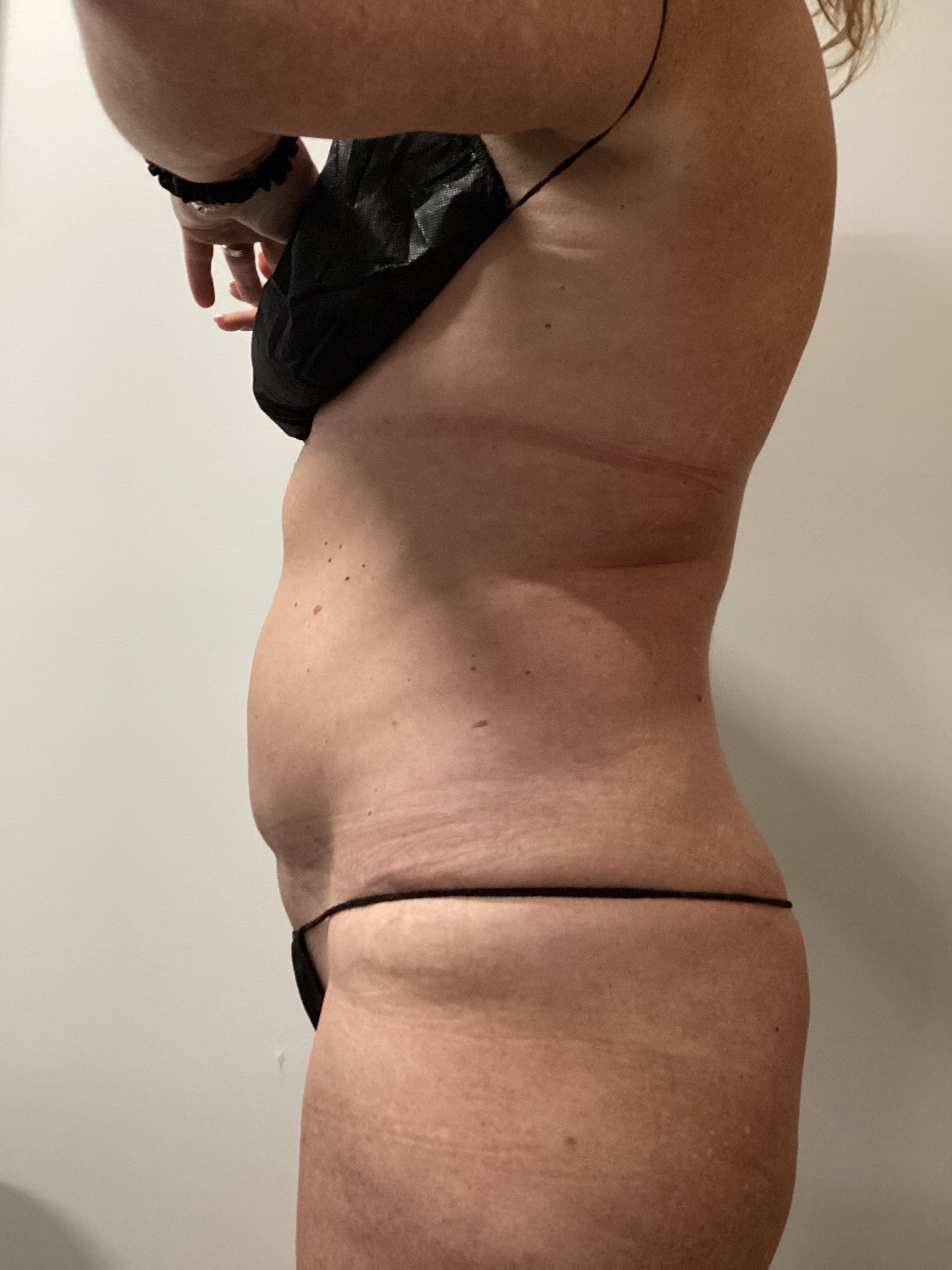 1 session insta ab-before