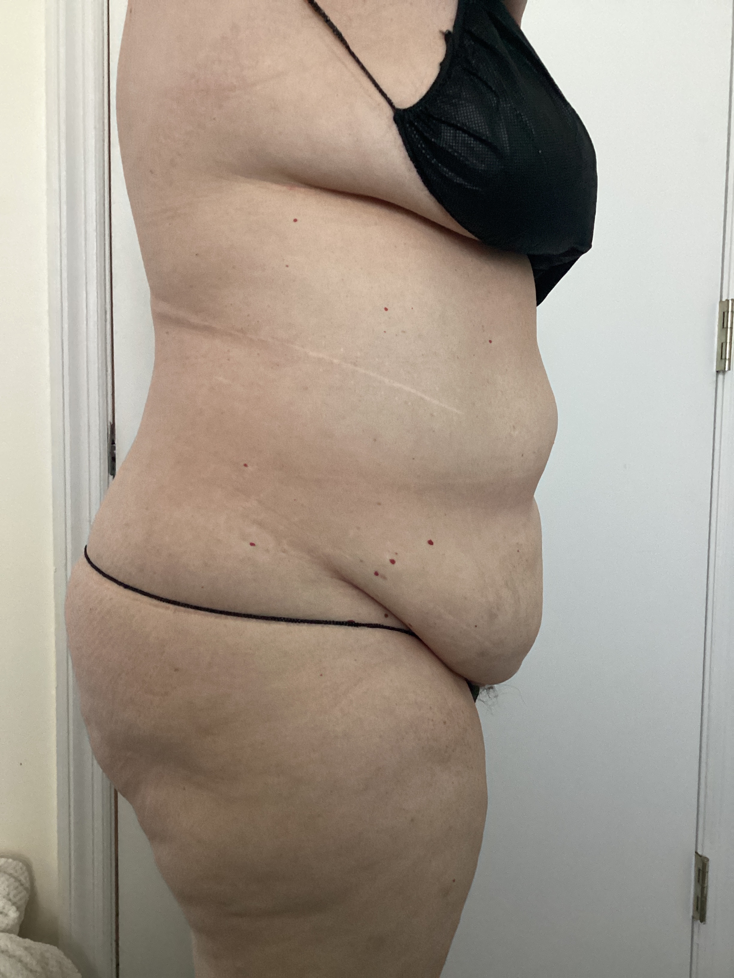 1 insta sculpting-after