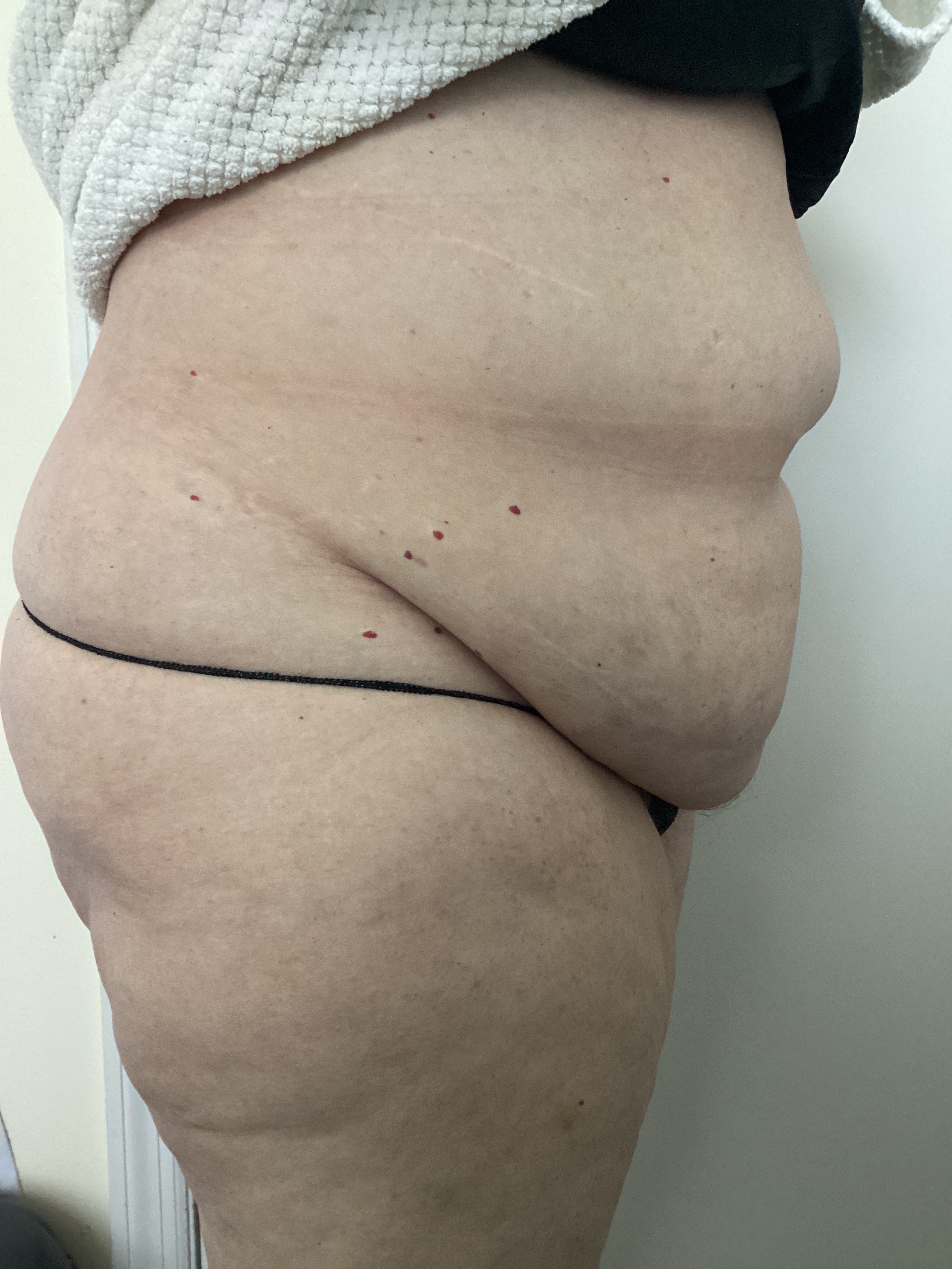 1 insta sculpting-before