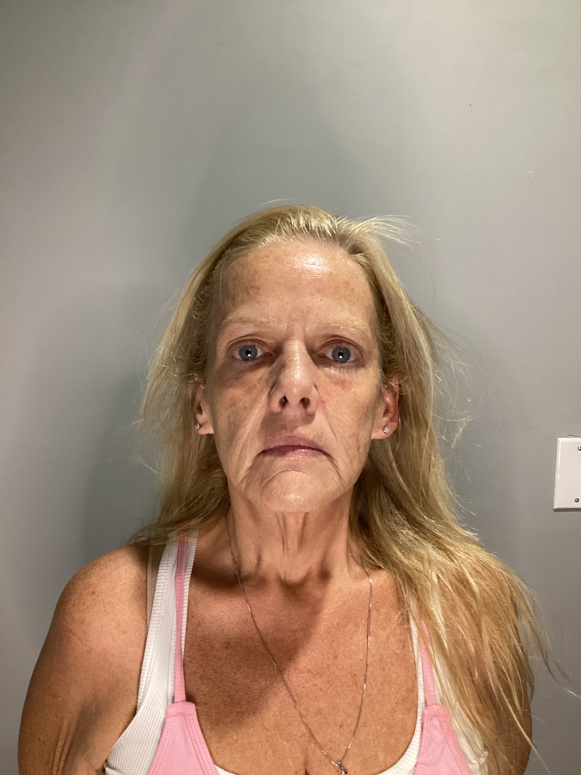 1 micro needling - 2 RF-after