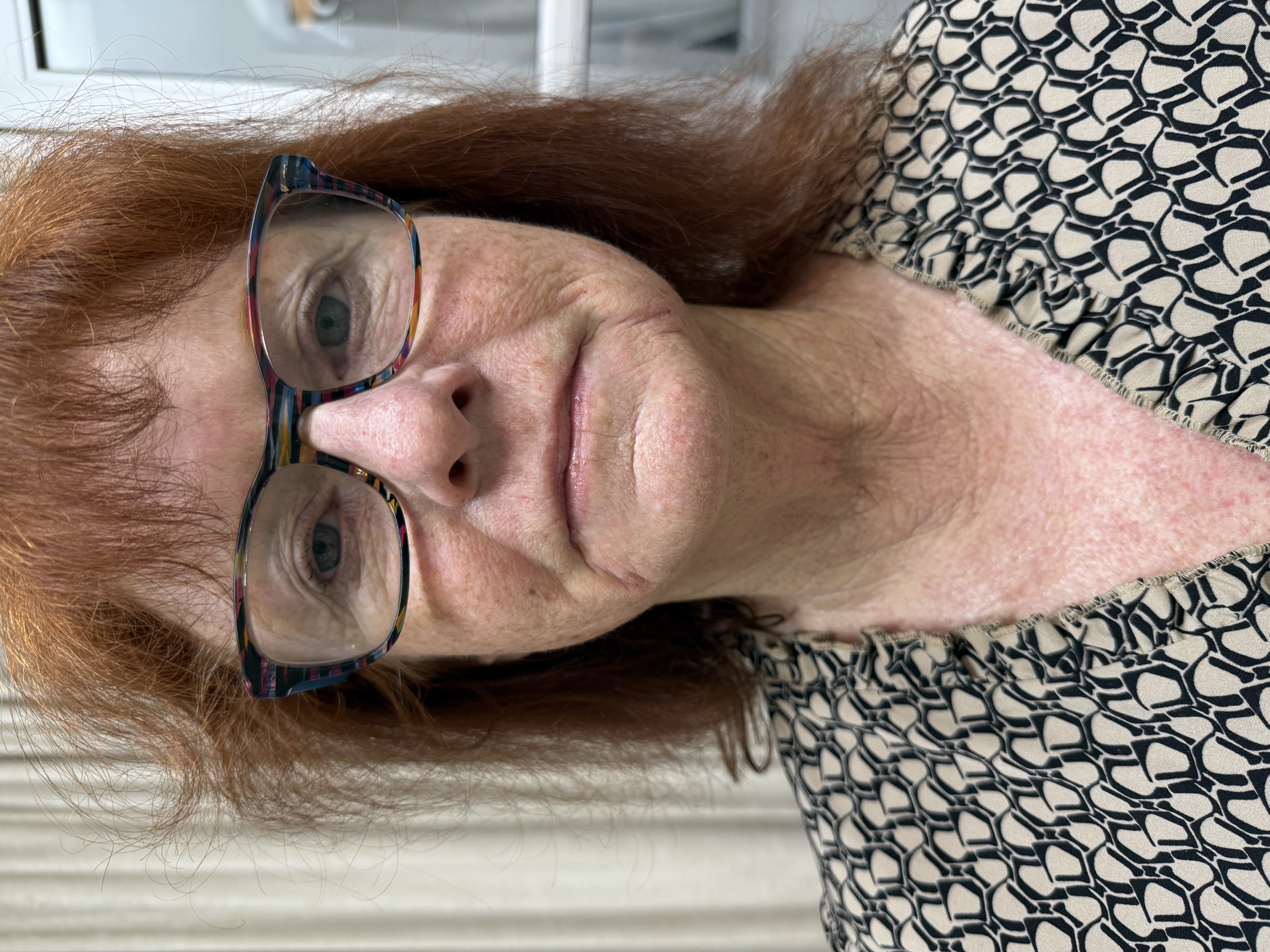 Morpheus 8 and Ultra-after