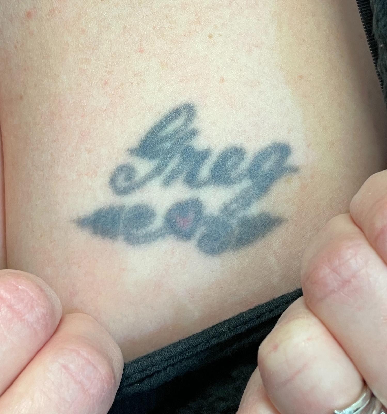 Ashley Reich RN: LTR-before