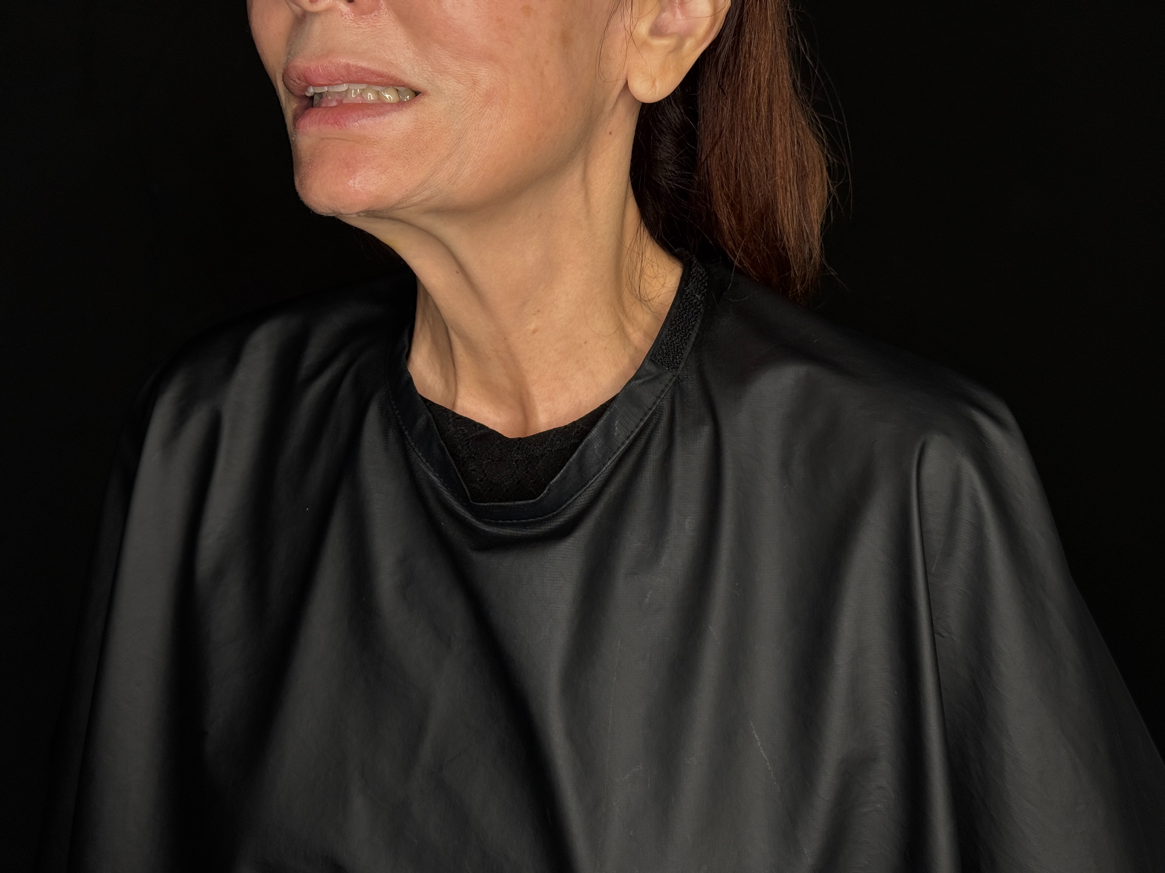 Ashley Reich RN: Platysmal Bands-after