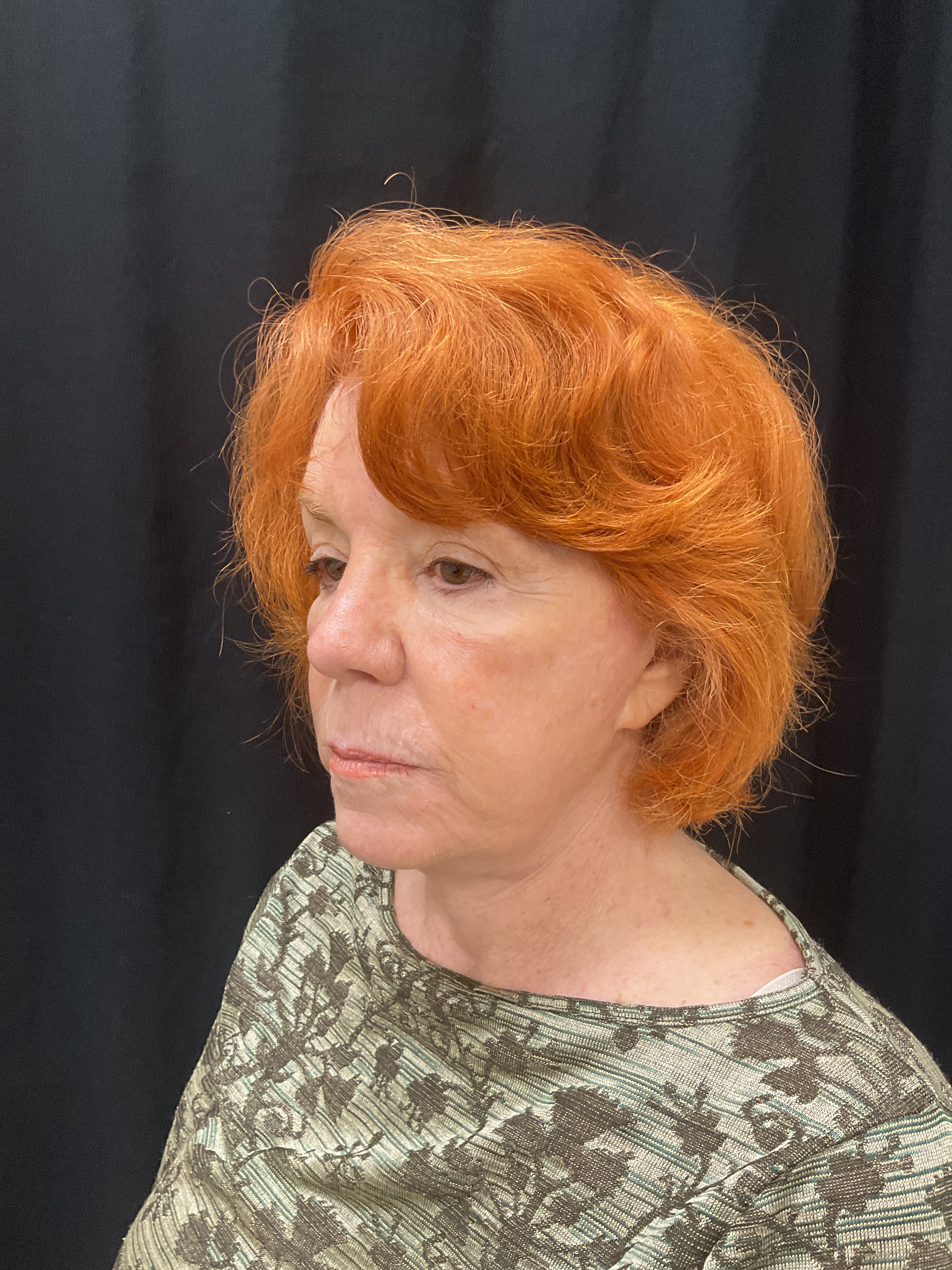 Linda Bertrum-after