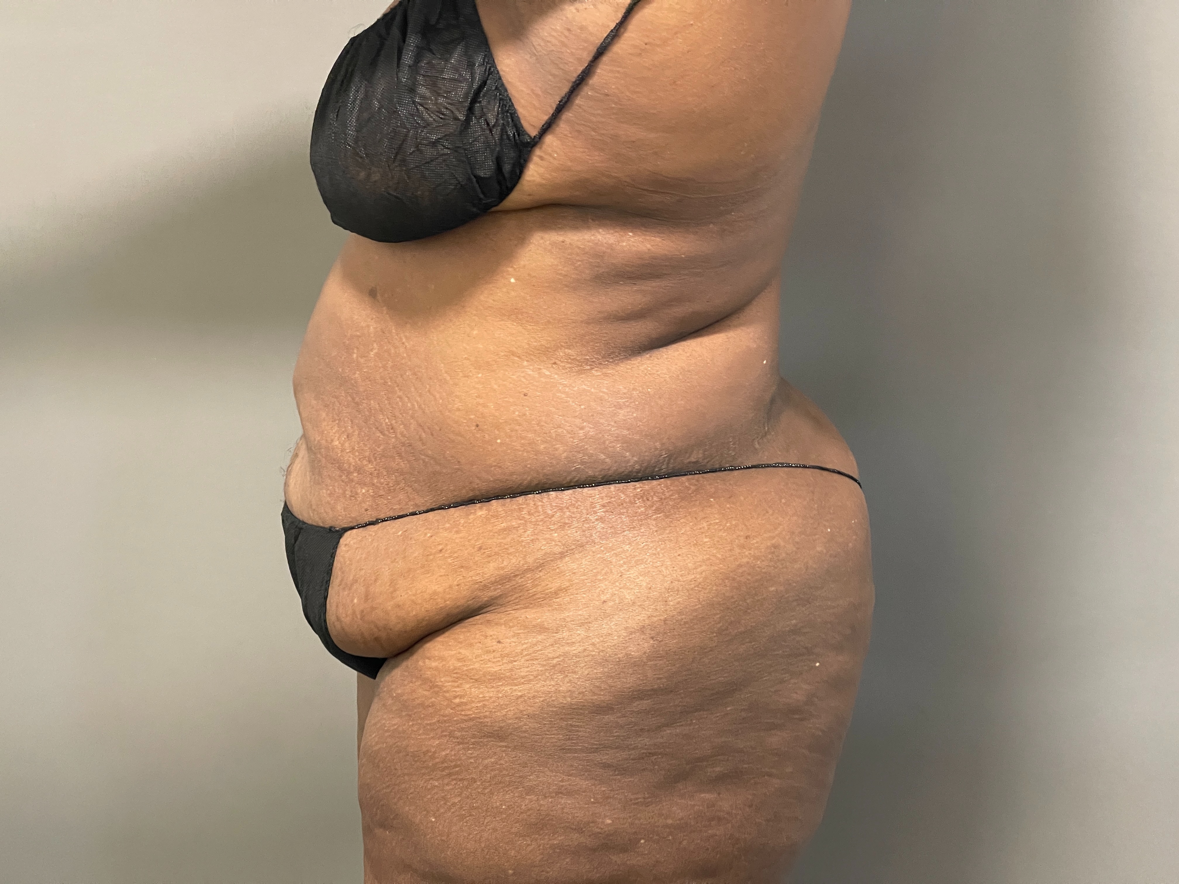 Leshonda Rogers-before