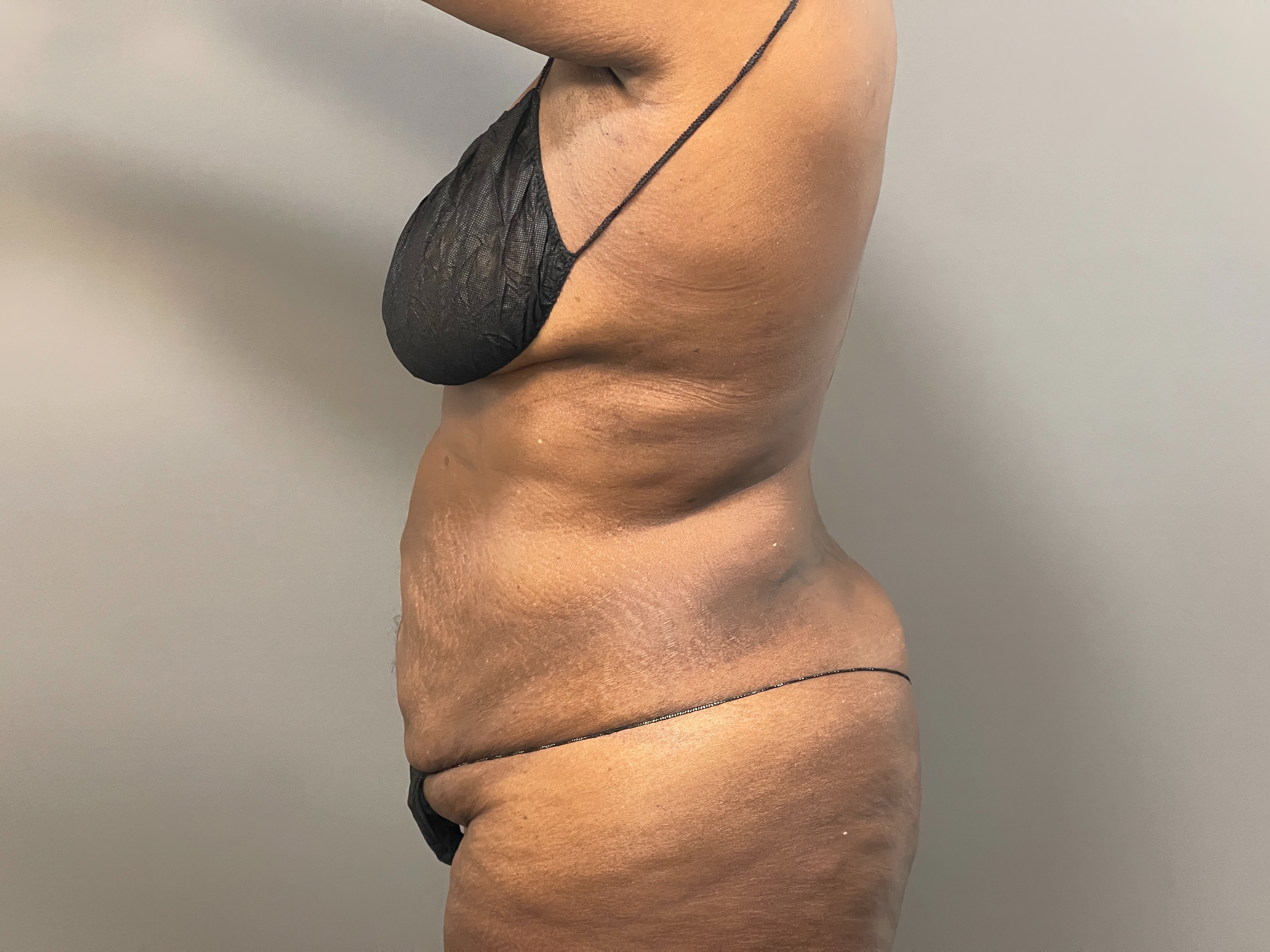 Leshonda Rogers-after