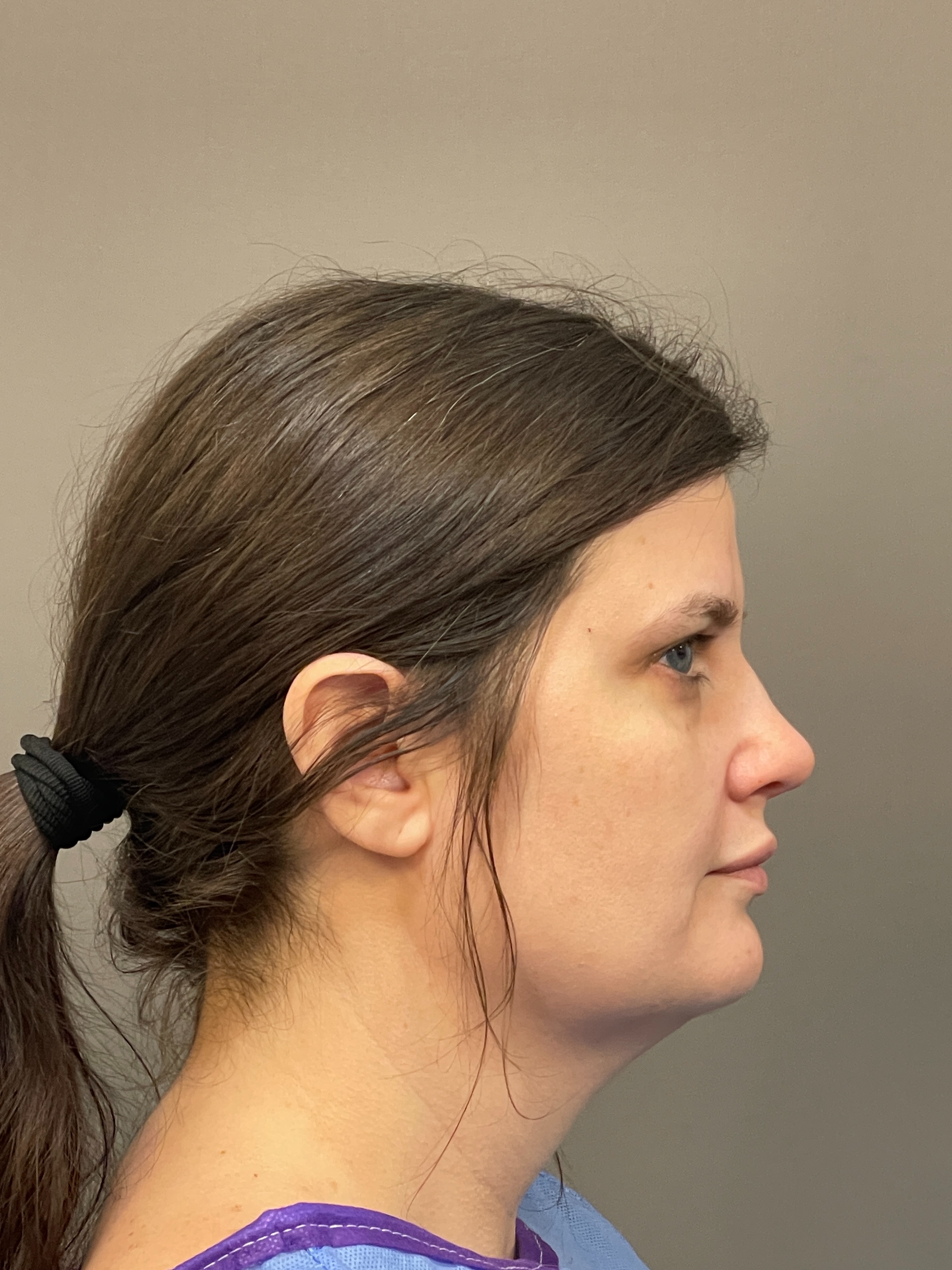 Brittany holli-before