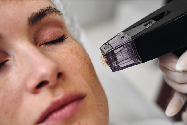 Microneedling
