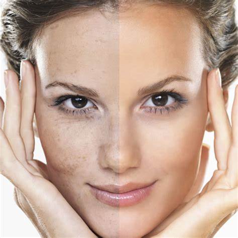 Laser and Light Treatments