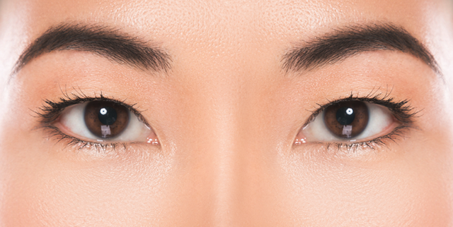 Asian Blepharoplasty